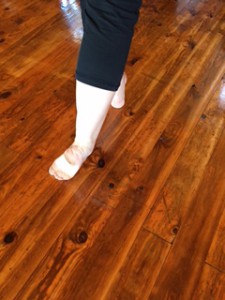 sickled feet in ballet