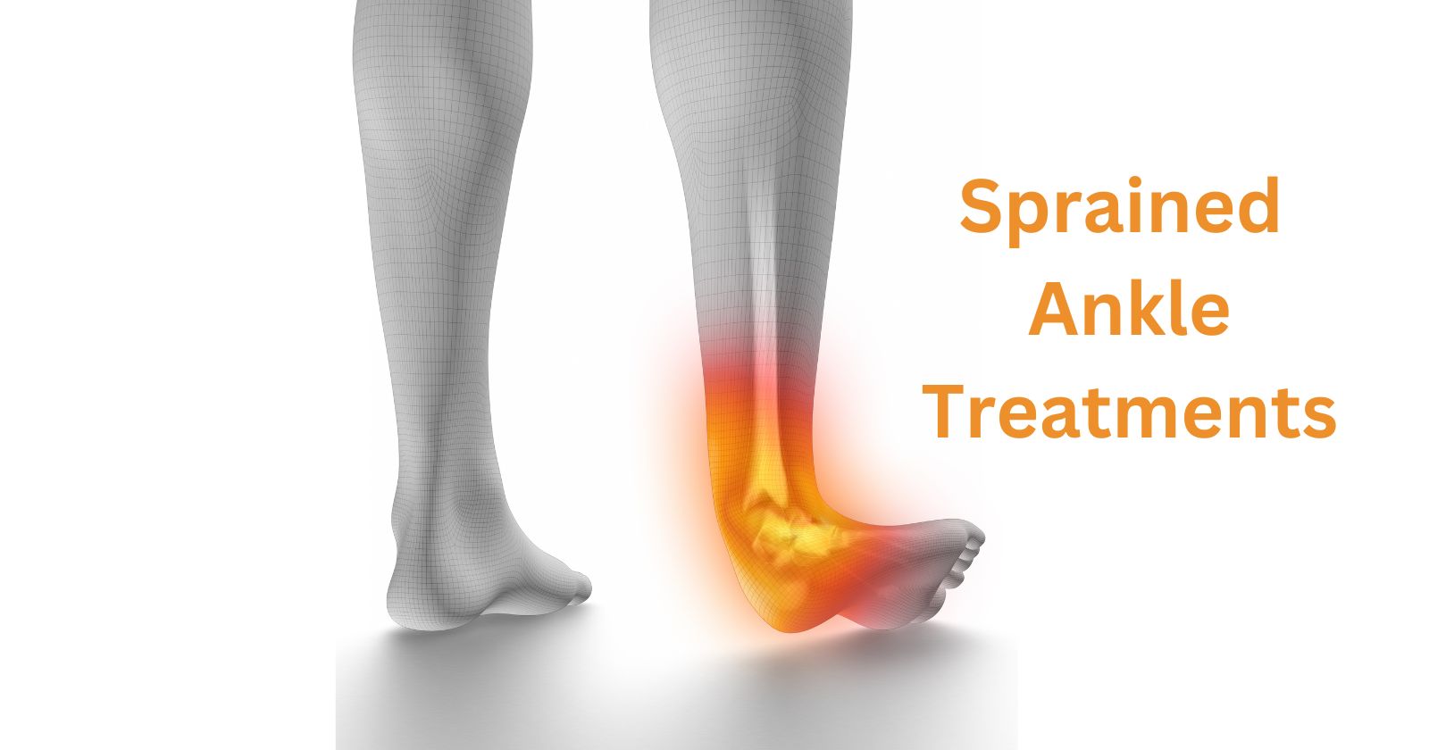 sprained ankle treatments